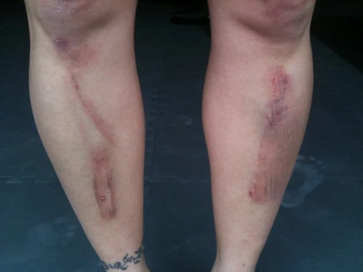 shins.webp