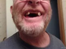 Missing Teef.webp