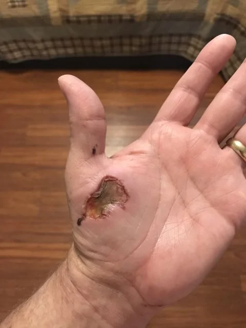 Hand.jpg