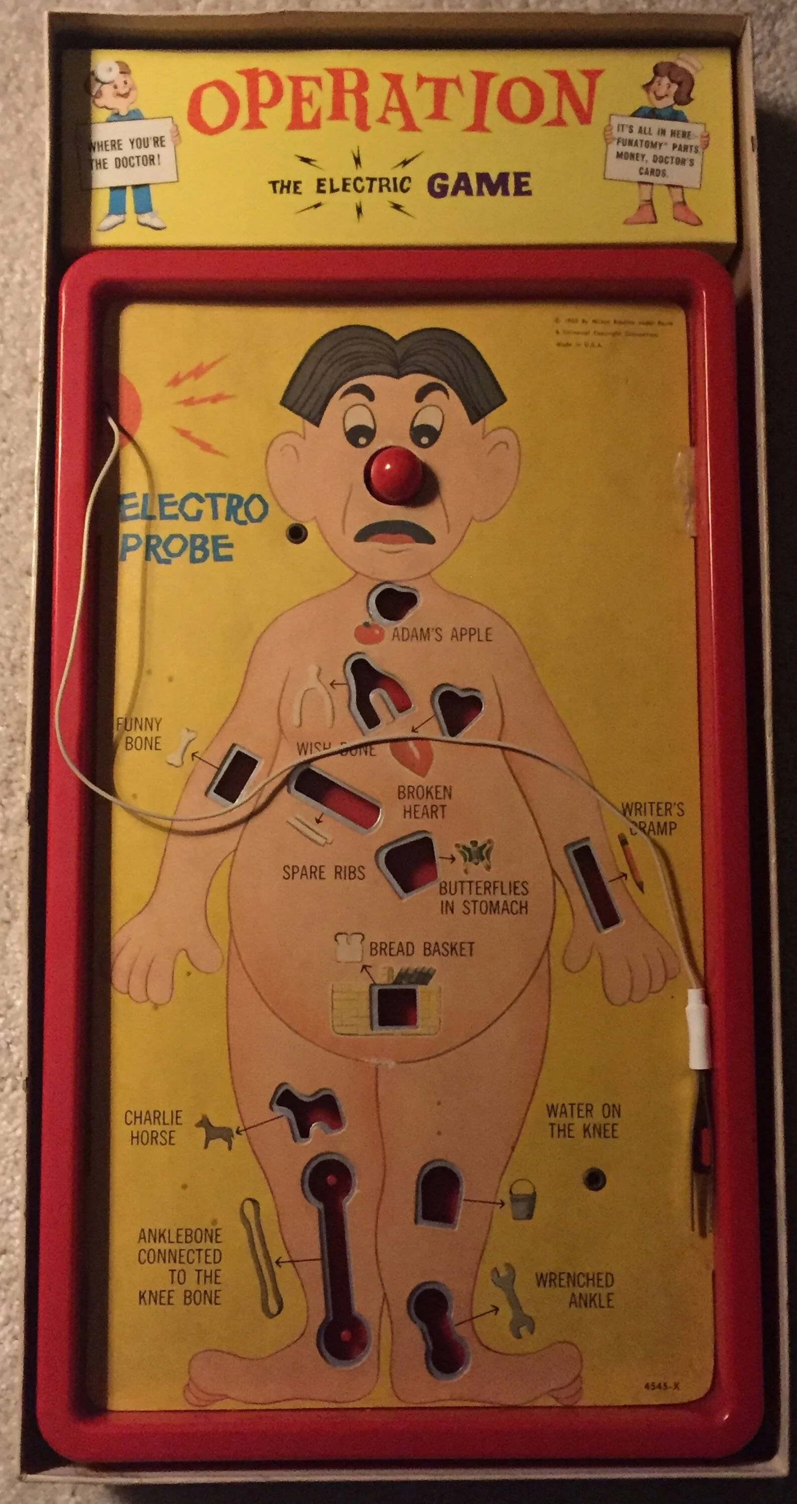 1960's_edition_of_Operation.webp