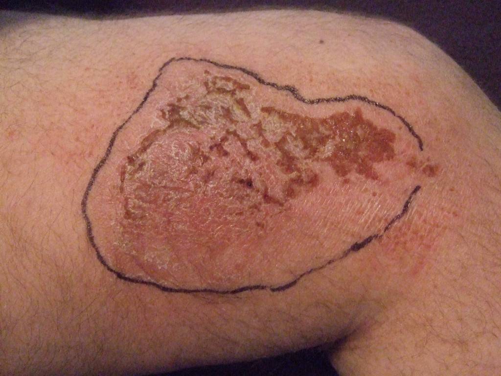 2 Days after CDS wrap applied .JPG