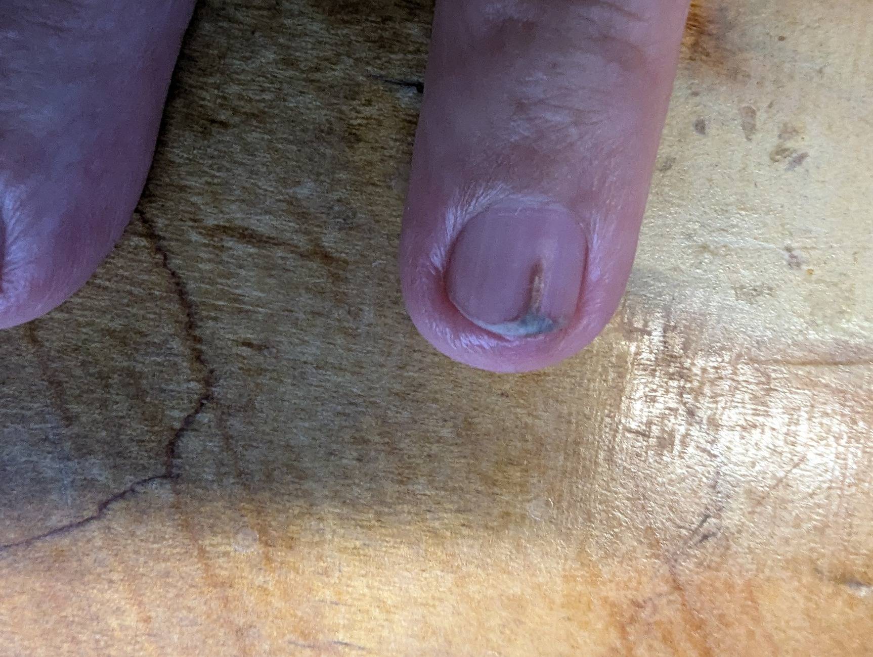 splinter.jpg