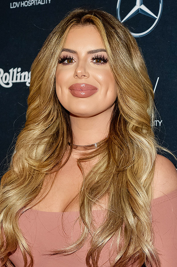 brielle-biermann-giant-lip-fillers-rex-embed-1.jpg