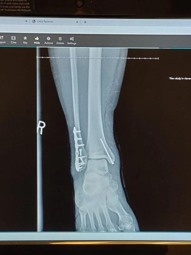 xray1.webp