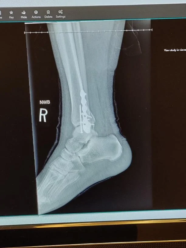 xray2.webp