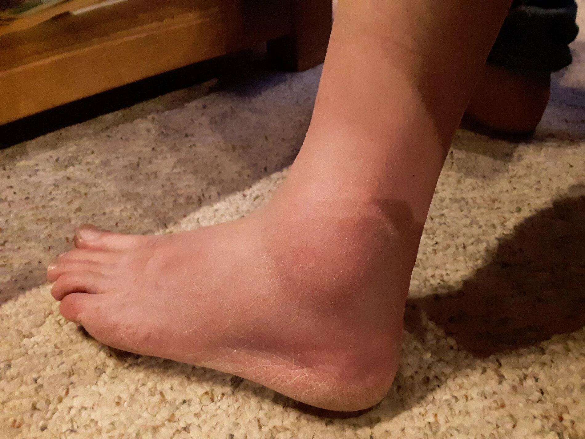 ankle.jpg