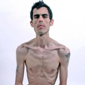 skinny-guy-genetics.webp