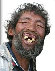 Rotten Teeth.webp